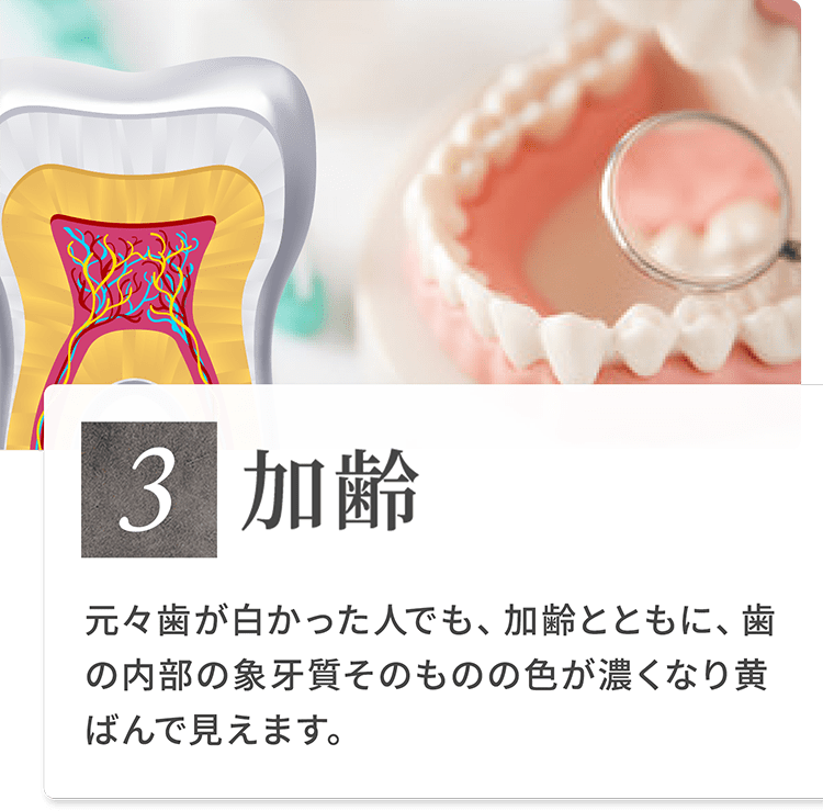 3）加 齢 元々歯が白かった人でも、加齢とともに、歯の内部の象牙質そのものの色が濃くなり黄ばんで見えます。