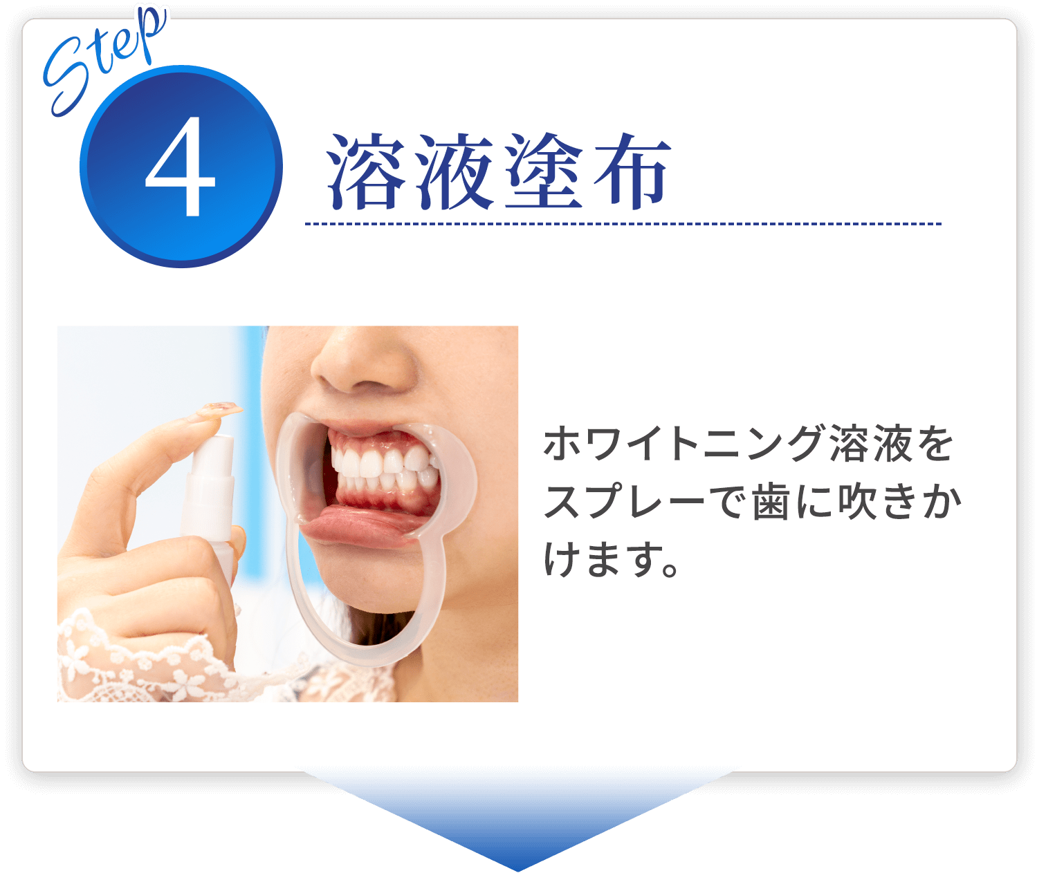 step04 溶液塗布 ホワイトニング溶液をスプレーで歯に吹きかけます。